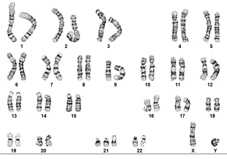 Karyotype Analysis